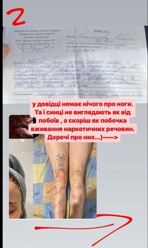 Побиття дівчини працівниками ТЦК це фейк - начальник штабу бригади "Азов"