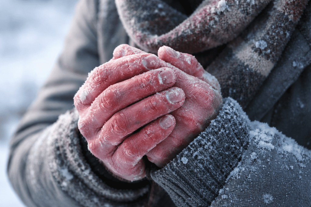 Обморожение конечностей: основные симптомы, степени поражения и пошаговая первая помощь. Практические советы и профилактика