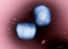 Частицы вируса mpox под электронным микроскопом