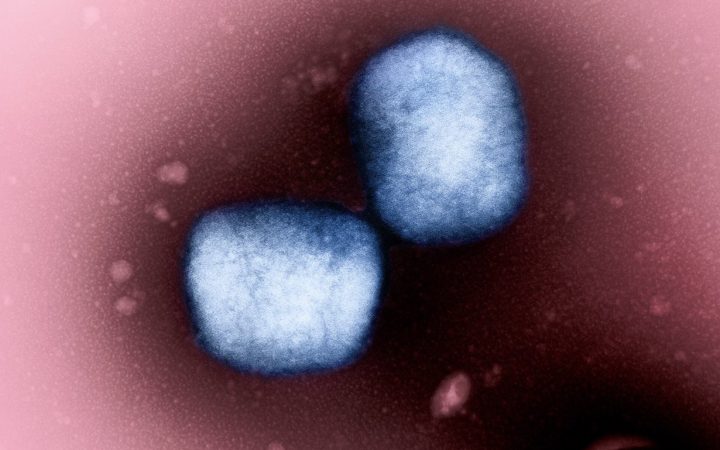 Частицы вируса mpox под электронным микроскопом