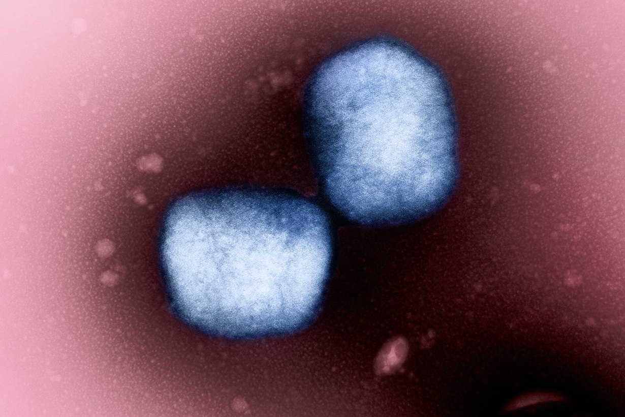 Частицы вируса mpox под электронным микроскопом