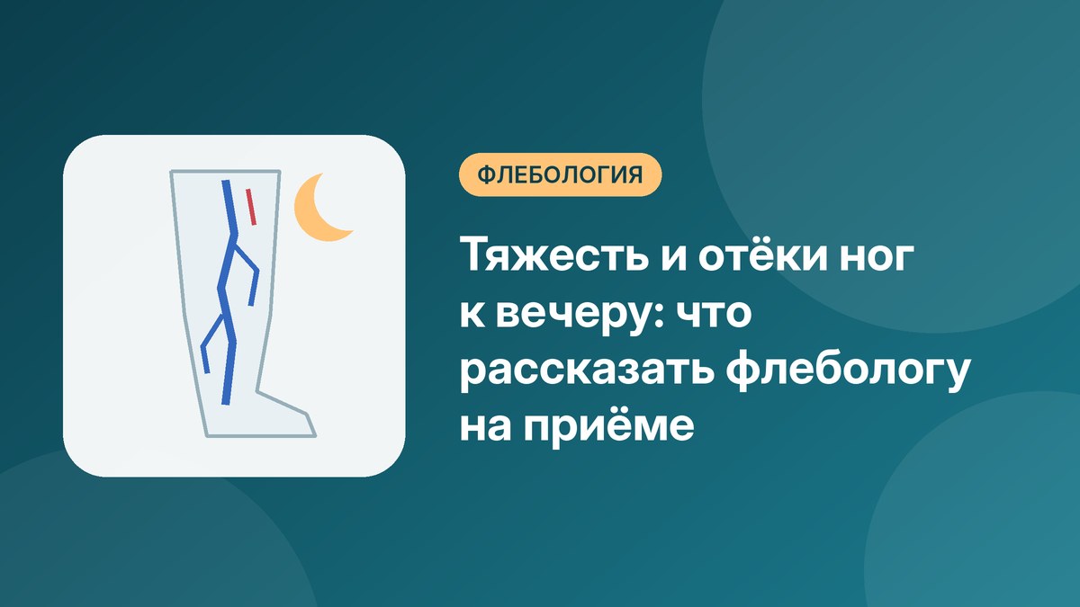 Тяжесть и отёки ног к вечеру: что рассказать флебологу на приёме
